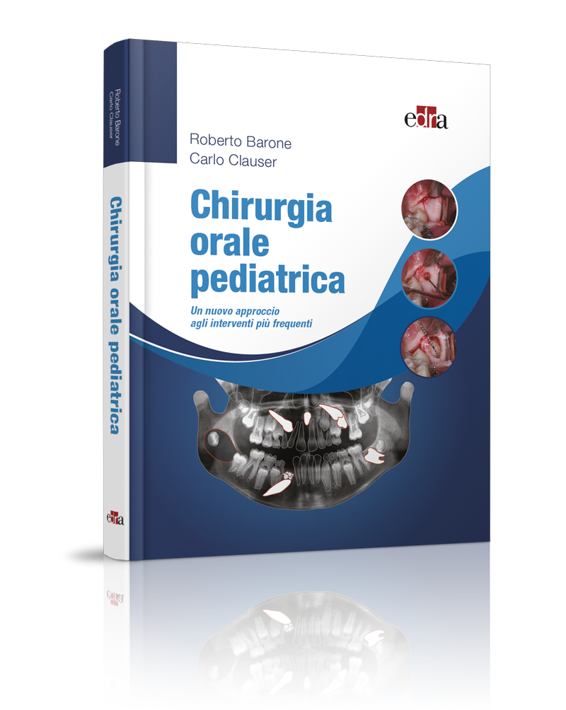Volume Chirurgia Orale Pediatrica
